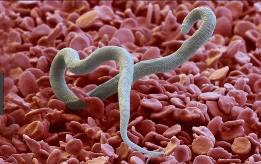 Worms in the human body