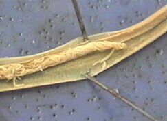 Parasite