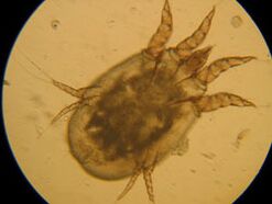 Under the microscope
